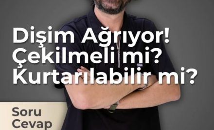 Diş Ağrıyor: Çekilmeli mi, Yoksa Kurtarılabilir mi?
