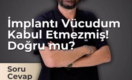 “Vücudum İmplantı Kabul Etmezmiş” Söylentisi Ne Kadar Doğru?
