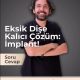 Eksik Dişe Kalıcı ve Doğal Çözüm: İmplant Tedavisiyle Gülüşünüzü Geri Kazanın